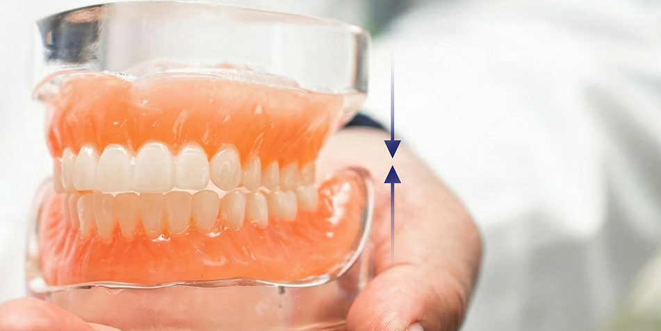 噛み合わせ治療