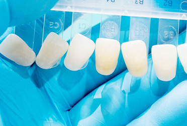 歯を失って噛みにくい