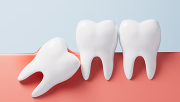 親知らずが横向きに生えて不安