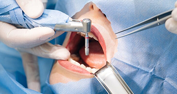 口内の腫れ・できものが気になる