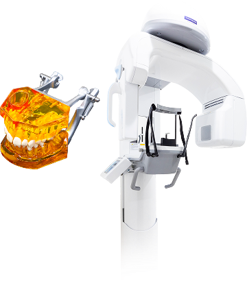 あなたのお口に合う、精度の高い技工物を院内で