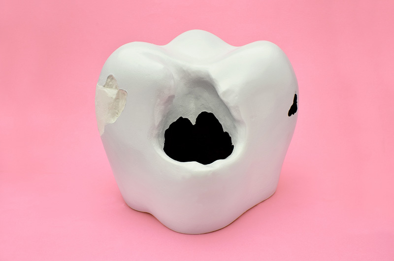 むし歯を放置する危険性