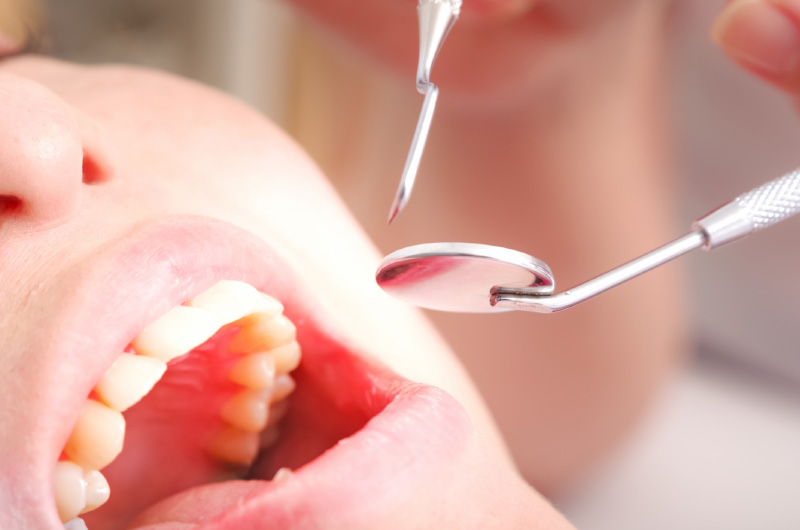 レーザー治療とは